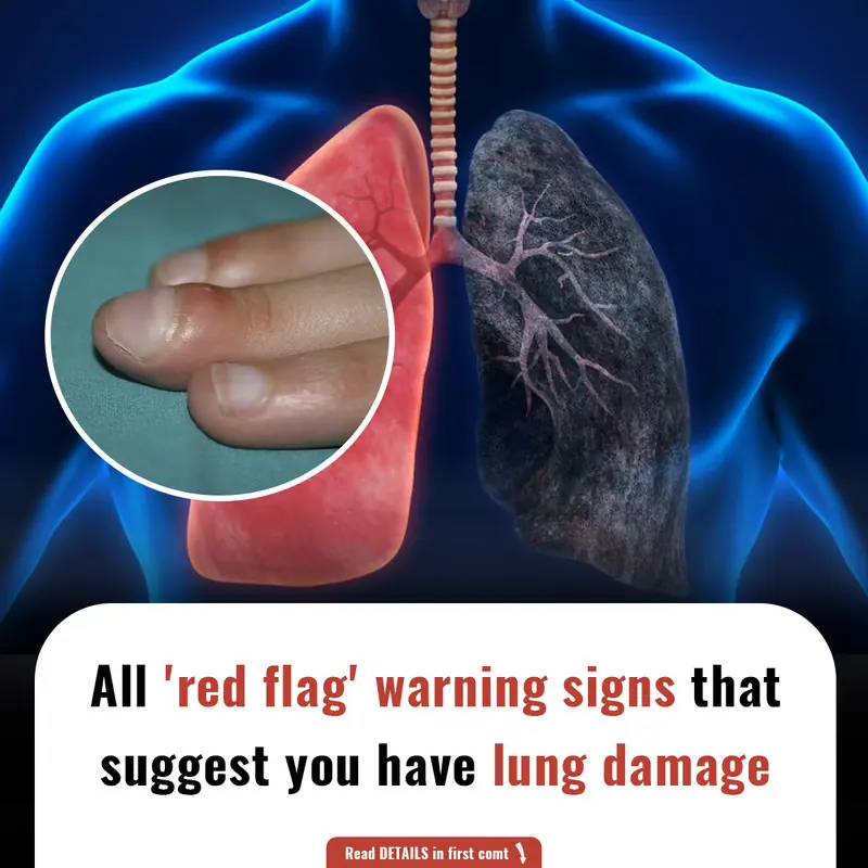 All 'red flag' warning signs that suggest you have lung damage