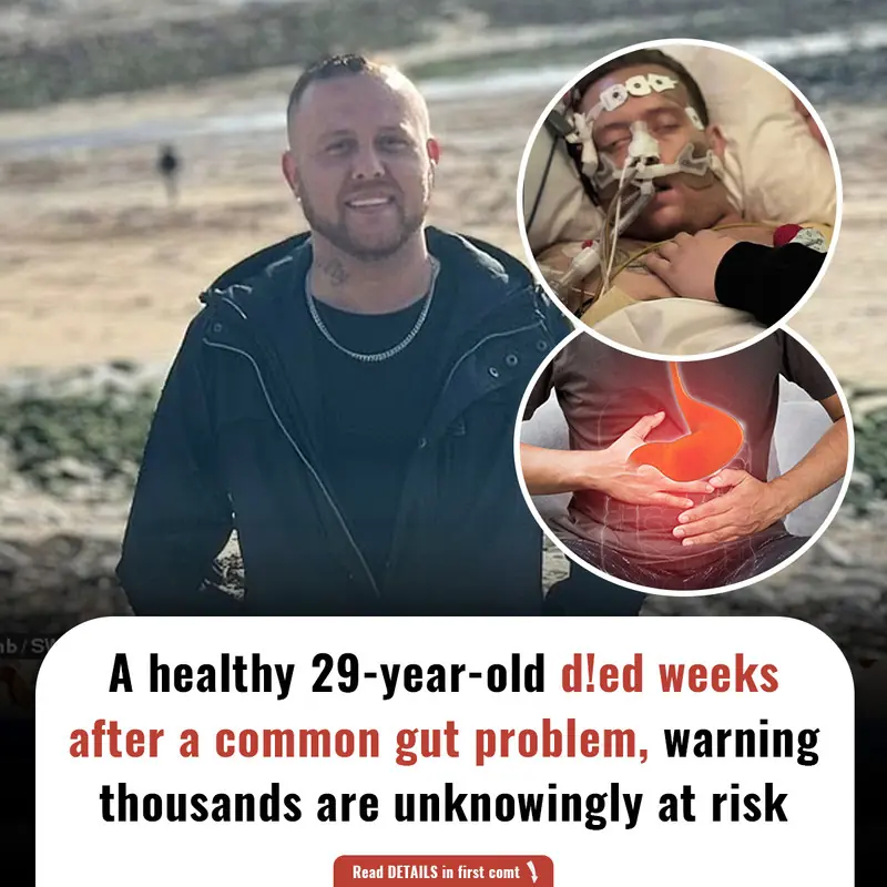 A healthy 29-year-old d!ed weeks after a common gut problem, warning thousands are unknowingly at risk.