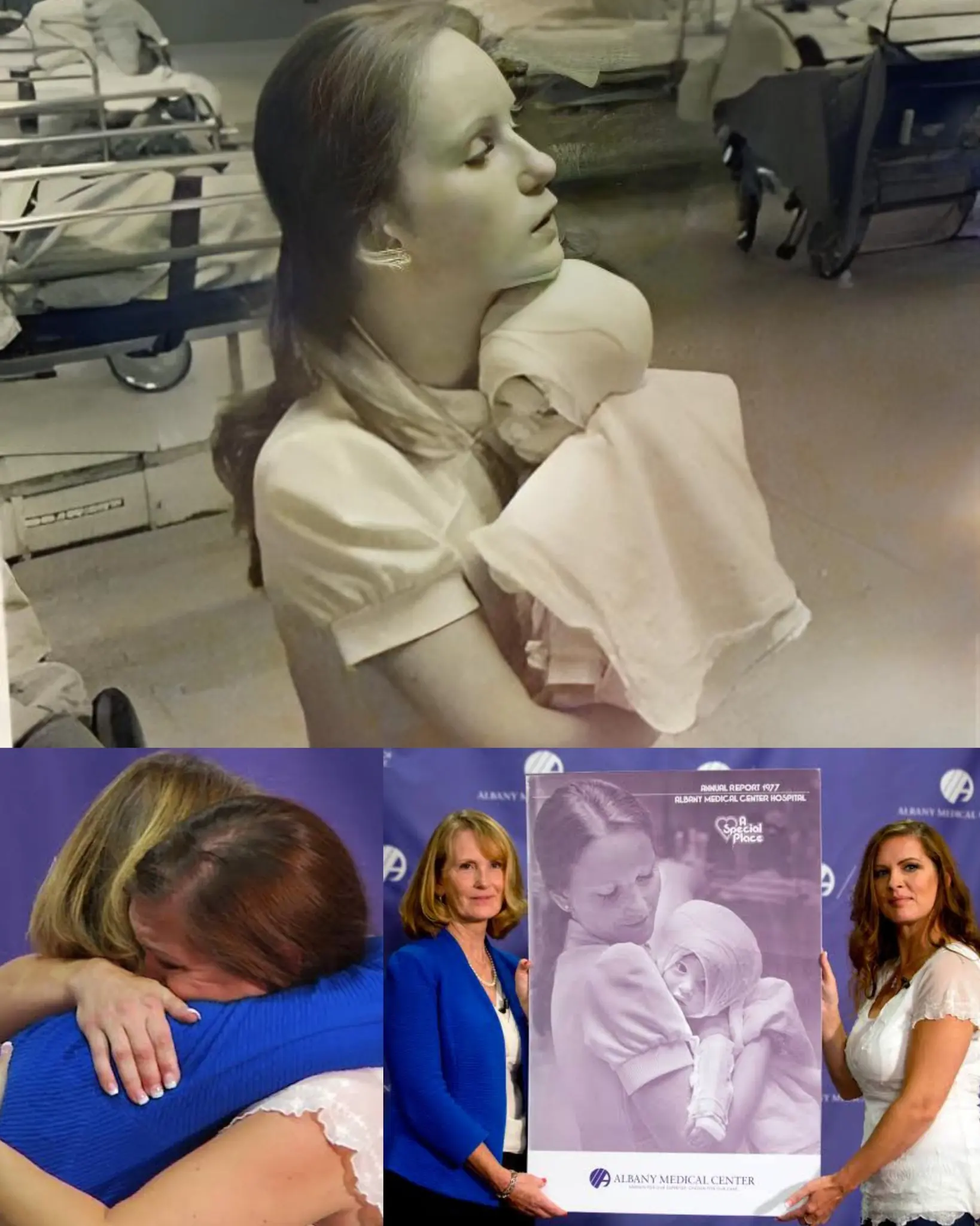 The Unforgettable Bond: How a Nurse's Compassion Changed a Burn Survivor's Life Forever