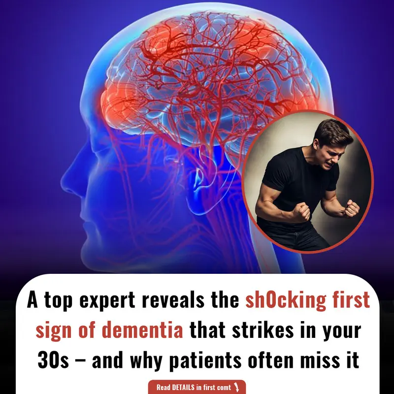 A top expert reveals the sh0cking first sign of dementia that strikes in your 30s – and why patients often miss it.