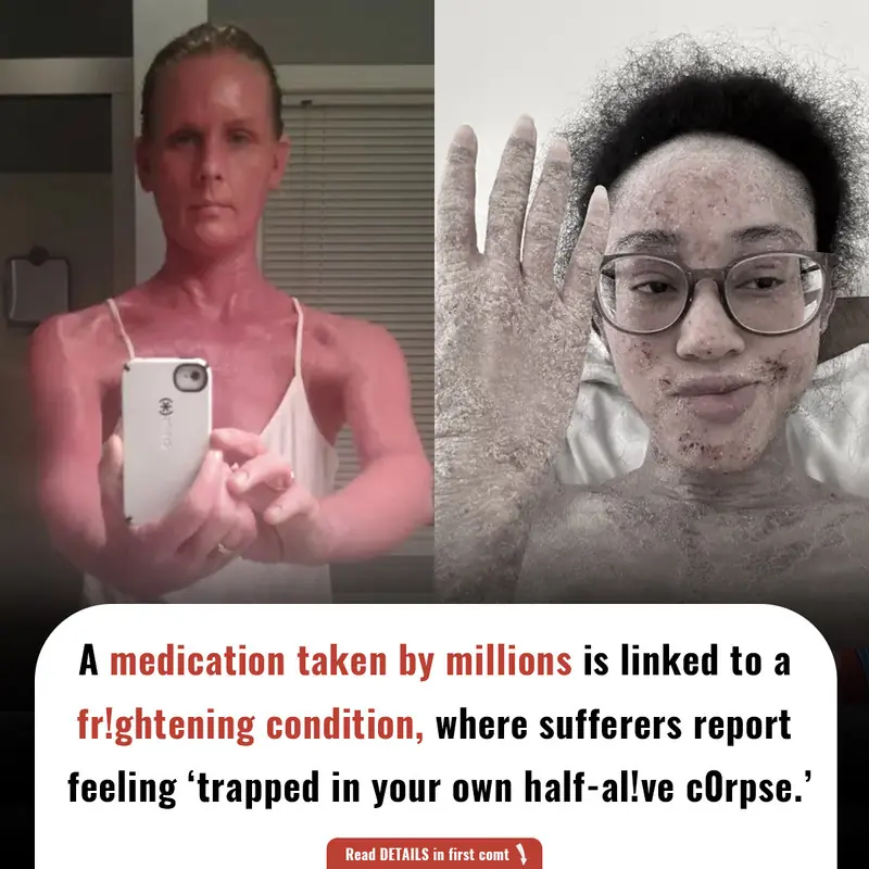 A medication taken by millions is linked to a frightening condition, where sufferers report feeling ‘trapped in your own half-al!ve c0rpse.’