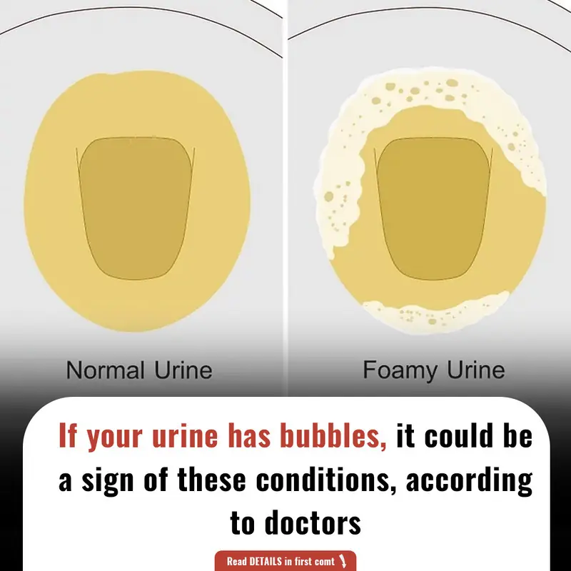 If your urine has bubbles , it could be a sign of these conditions, according to doctors
