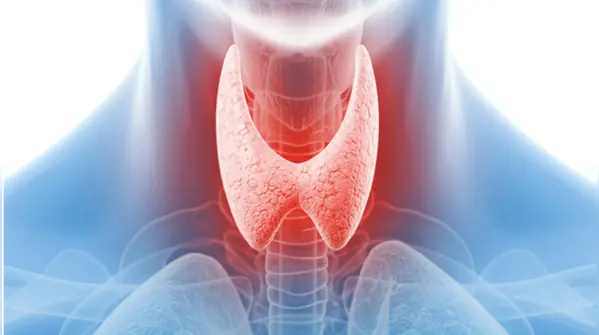 5 Common Areas Where Thyroid Pain Can Appear: Symptoms & Treatments