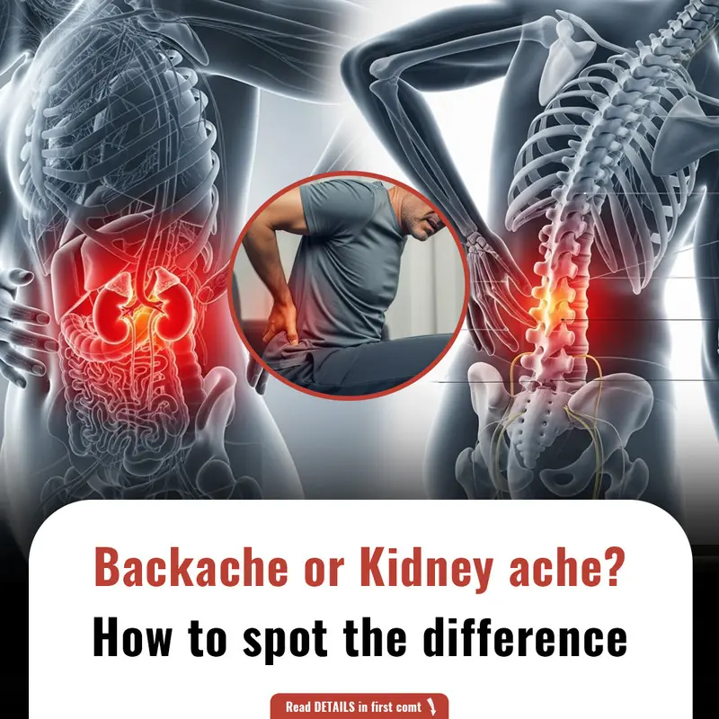 Backache or Kidney ache? How to spot the difference
